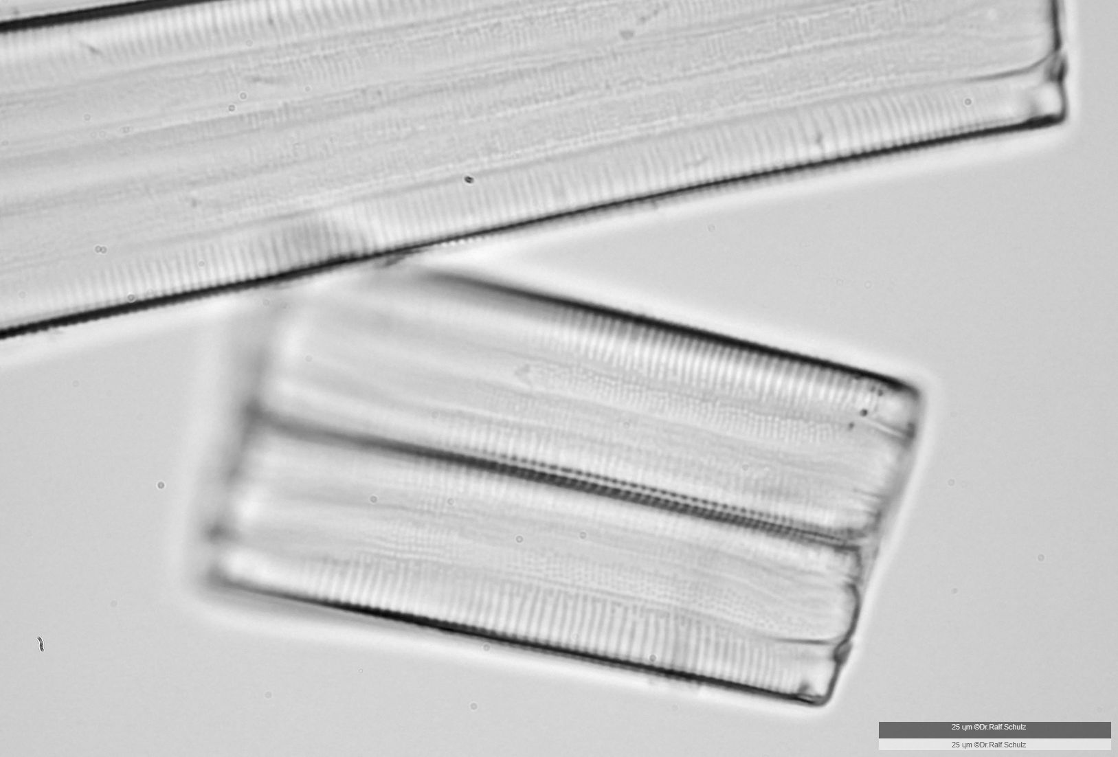 Eunotia formica Gürtelansicht