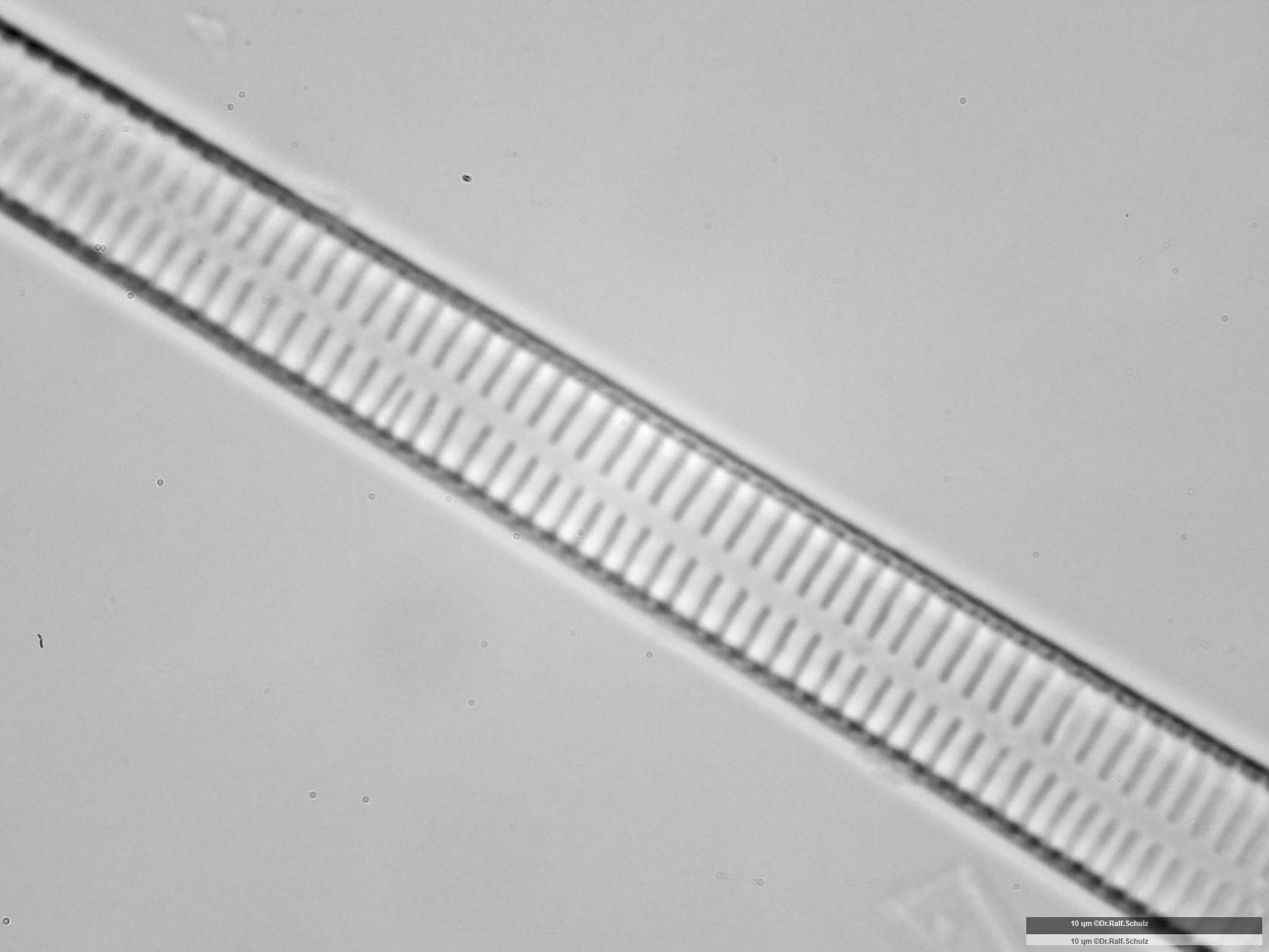 Fragilaria ulna var ulna 1 Axialarea 20250227 Ca100AHf1p 00145 hp